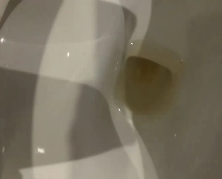 yellow toilet water